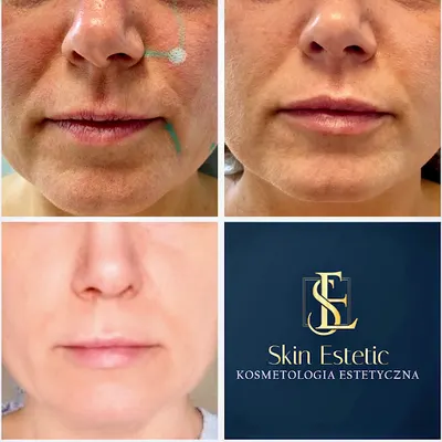 SKIN ESTETIC - Kosmetologia Estetyczna - Joanna Mendera